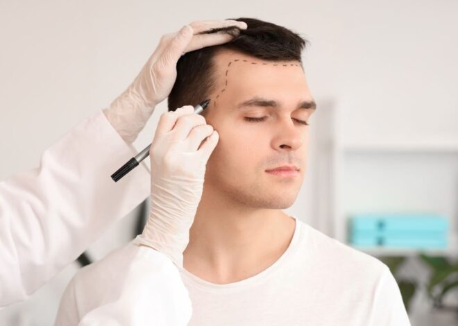 Best Hair Transplant Centers in Dubai: Advanced Procedures and Quality Service
