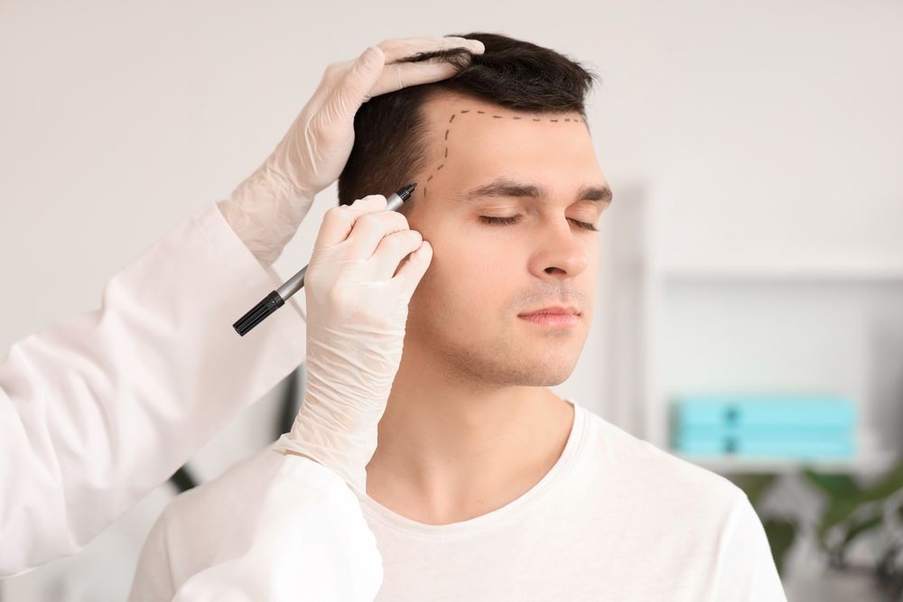 Best Hair Transplant Centers in Dubai: Advanced Procedures and Quality Service